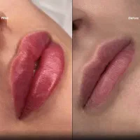 /کاشت مو و ابرو اقساطی /بلفارو /خدمات زیبایی