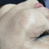 جشنواره یلدایی هایفو تراپی|خدمات آرایشگری و زیبایی|کوهدشت, |دیوار