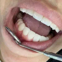 دوره دستیاری/تکنسین دندانپزشک منشی پزشک/کمک بکار|استخدام درمانی، زیبایی، بهداشتی|اصفهان, شاهزید|دیوار