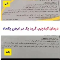 پاکسازی کبد چرب تضمینی|خدمات آرایشگری و زیبایی|گرگان, |دیوار