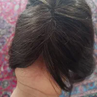 پوستیژ
