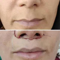 جشنواره تابستان عمل زیبایی|خدمات آرایشگری و زیبایی|قم, باجک دو|دیوار