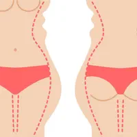 جشنواره اقساطی عمل بینی، لیپو، ابدو، پیکر تراش|خدمات آرایشگری و زیبایی|اصفهان, ملکشهر|دیوار