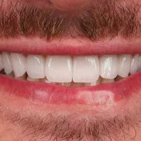 خدمات دندانپزشکی و زیبایی دندان