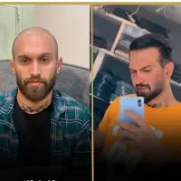 جشنواره طلایی کاشت مو،حرفه ای و تخصصی ،آموزش