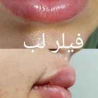 تخفیف ویژه خدمات زیبایی|خدمات آرایشگری و زیبایی|کوهدشت, |دیوار