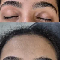 اصلاح تخصصی ابرو درحمیدیان