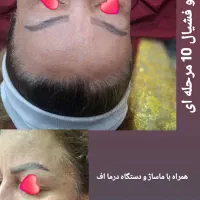 امروز یکنفر مدل پاکسازی و... فقط 250