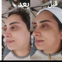 اموزش وخدمات تخصصی پوست وموتا ۲۰بهمن فقط ۴۵۰۰