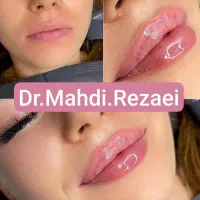 تنهامرکزلیفت صورت،بابیشترین تعدادنخاردارونخبدونخار|خدمات آرایشگری و زیبایی|مشهد, نیروی هوایی|دیوار