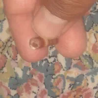 سنگ زیبا سوراخی