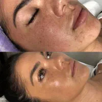 آموزش پردرآمد ترین لاین های پوست و مو لیزر پاکسازی|خدمات آموزشی|اهواز, نادری|دیوار