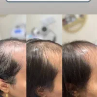 آموزش اسکالپ سر با ضمانت یادگیری/شروع کلاس 1آذر