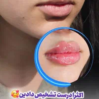 ۴۵۰،۰۰۰ ت هدیه باشگاه مشتریان یاناومایا (فیلر لب)|خدمات آرایشگری و زیبایی|دزفول, |دیوار