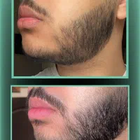 جذابیت ریش