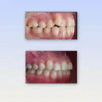 ارتودنسی دکتر عسکری وزیری