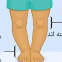 مرکز ارتوپدی اصلاح غیرجراحی انحرافات زانو|خدمات آرایشگری و زیبایی|همدان, |دیوار