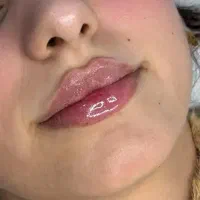فیلر صورت حرفه ای