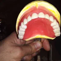 ساخت دندان مصنوعی|آرایشی، بهداشتی، درمانی|لردگان, |دیوار