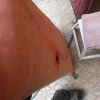 چهار عدد پشتی آنتیک|کلکسیون اشیاء عتیقه|هشتگرد, فاز ۱ مهستان|دیوار