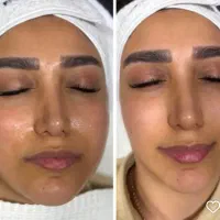 دوره تخصصی آموزش مزوژل و جوانسازی پوست و پاکسازی|خدمات آموزشی|تهران, چیتگر جنوبی|دیوار