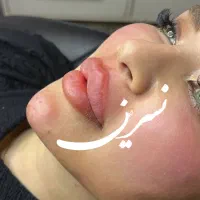 کلینیک زیبایی فیلرلب روسی و مدلینگ عربی