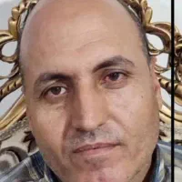 کاشت مو و ابرو