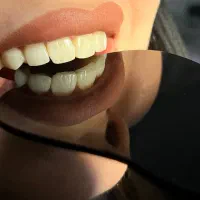 خدمات اقساطی دندانپزشکی و زیبایی دندان