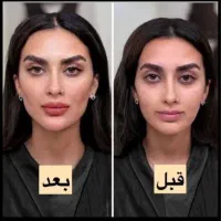 فقط امروز  ۹۸۰ /کانتورینگ/فیلر/تعدادمحدود|خدمات آرایشگری و زیبایی|رشت, کوی حسینی|دیوار