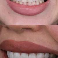 مرکز تخصصی کامپوزیت دندان|خدمات آرایشگری و زیبایی|مشهد, ملک‌آباد|دیوار