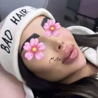 خدمات ژل وبوتاکس مادلینگ عروسکی وعربی