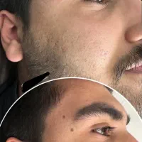 کلینیک زیبایی پوست(خالبرداری،فیشال تخصصی،ریمووتاتو