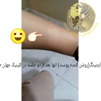 کلینیک لیزر پوست،مو جهانطلا در کرمانشاه (فوتونا)|خدمات آرایشگری و زیبایی|کرمانشاه, |دیوار