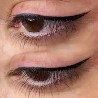 میکرو بلیدینگ وپیگمنتیشن با50درصد تخفیف