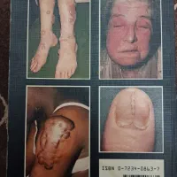 کتاب پزشکی برای بیماری هاز پوستی