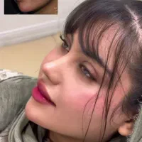 عمل بینی پیکرتراشی پروتزسینه ابدولیپو اقساط بی سود