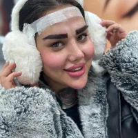 کاشت ابرو دائمی تضمینی