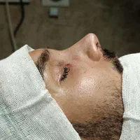 جراحی بینی ۲۴میلیون|خدمات آرایشگری و زیبایی|اسلامشهر, شهرک قائمیه|دیوار