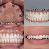 تمامی خدمات دندانپزشکی با بهترین کیفیت و اقساطی