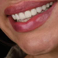 دندانپزشکی ایمپلنت کامپوزیت روکش لمینت‌ ارتودنسی|خدمات آرایشگری و زیبایی|تبریز, |دیوار