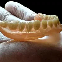 ساخت دندان مصنوعی اقساط با چک صیادی|خدمات آرایشگری و زیبایی|پردیس, فاز ۸|دیوار