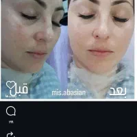 کربوکسی تراپی