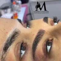 آف میکروبلیدینگ بن موژه شیدینگ ریمو و اصلاح بدرنگی