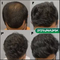 کلینیک زیبایی و کاشت مو و ابرو تخصصی