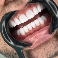 خدمات دندانپزشکی