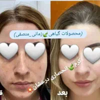 کرم ضدلک و روشن کننده درخشان(بدون بازگشت)|حراج|مشهد, بهشت|دیوار
