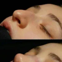 جراحی عمل بینی/لیپو ابدو/بلفارو/لیفت/لیپو ساکشن|خدمات آرایشگری و زیبایی|تهران, فلسطین (میدان انقلاب)|دیوار