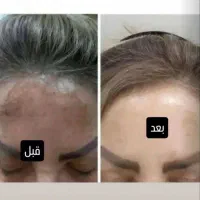 کرم معجزه گیاهی