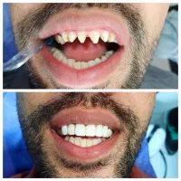 دندانپزشکی.کامپوزیت.ارتودنسی.روکش.عصبکشی|خدمات آرایشگری و زیبایی|کرمانشاه, |دیوار