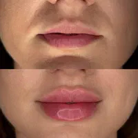 خدمات زیبایی